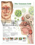 Understanding the Common Cold Anatomical Chart, 2nd Edition